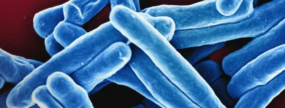 Acceptability and safety of one versus three months of rifapentine and isoniazid to prevent tuberculosis in people exposed in the household or workplace in Brazil: The Ultra-Curto randomized controlled trial